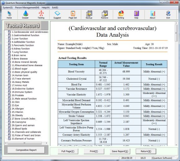 Sample Biofeedback Report (Click to Enlarge)