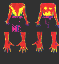 Body Temperature after stimulation to hands