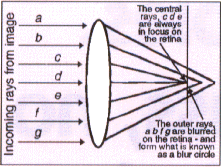 pinholes long short sighted cataracts optometrist suppliers opthalmology astigmatism eye strain pinholes pinhole spectacles pinhole spectacles presbyopia double vision cross eyed seeing perception improved eyesight pinhole glasses blurred 20/20 spectacles optometry